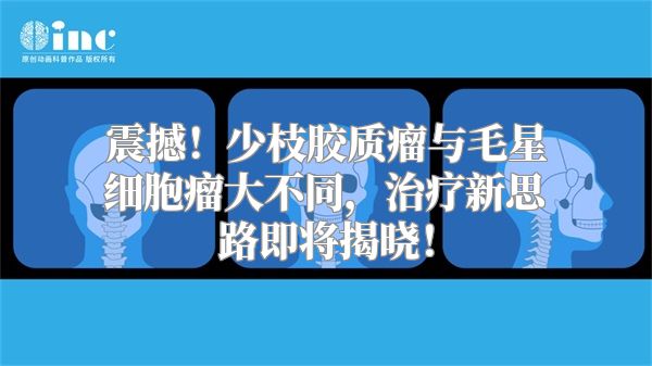 震撼！少枝胶质瘤与毛星细胞瘤大不同，治疗新思路即将揭晓！