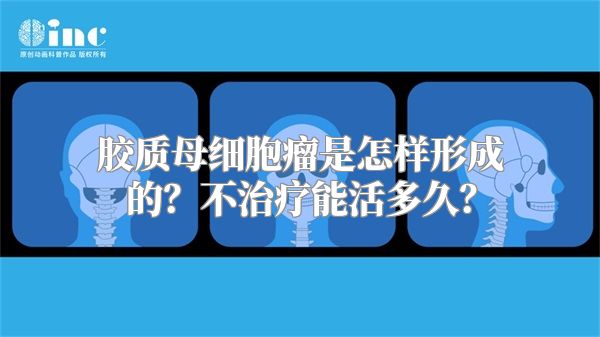 胶质母细胞瘤是怎样形成的？不治疗能活多久？