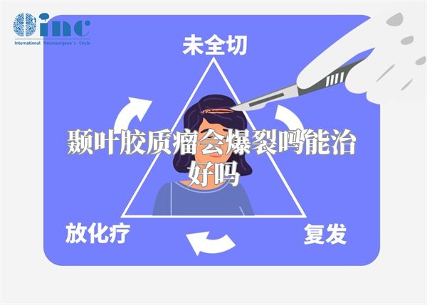 颞叶胶质瘤会爆裂吗能治好吗