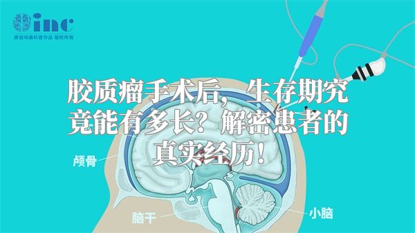 胶质瘤手术后，生存期究竟能有多长？解密患者的真实经历！