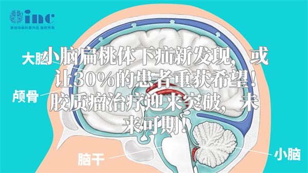 小脑扁桃体下疝新发现，或让30%的患者重获希望！胶质瘤治疗迎来突破，未来可期！