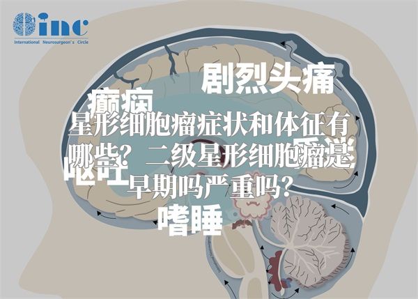 星形细胞瘤症状和体征有哪些？二级星形细胞瘤是早期吗严重吗？