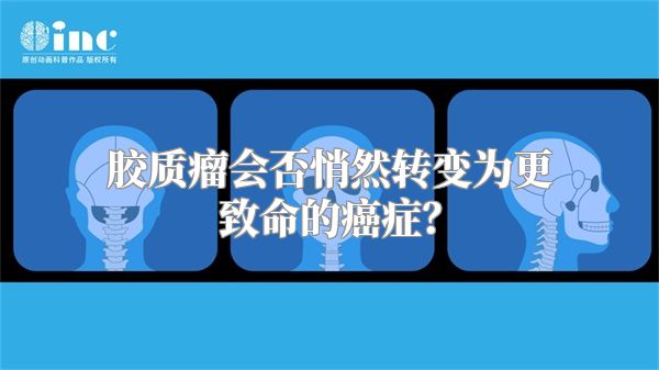 胶质瘤会否悄然转变为更致命的癌症？