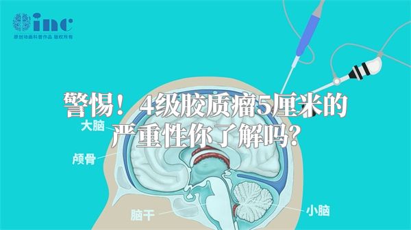 警惕！4级胶质瘤5厘米的严重性你了解吗？