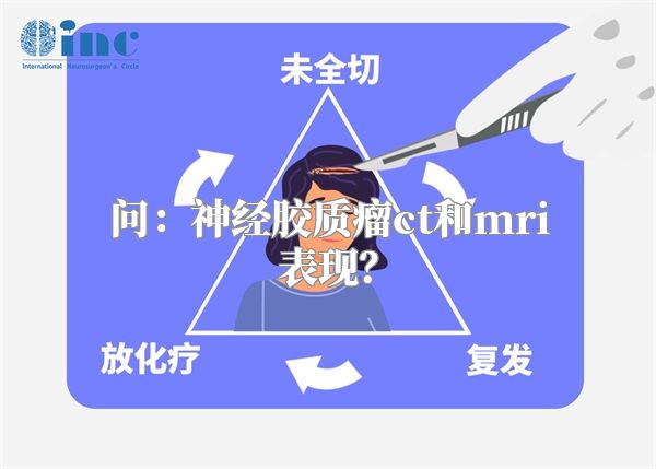 问：神经胶质瘤ct和mri表现？