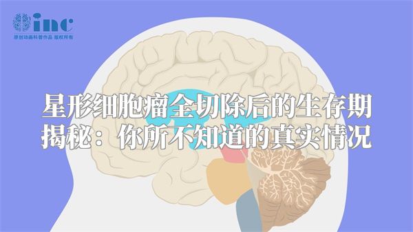 星形细胞瘤全切除后的生存期揭秘：你所不知道的真实情况