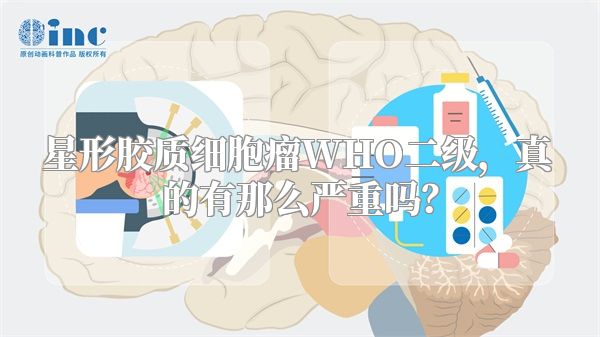 星形胶质细胞瘤WHO二级，真的有那么严重吗？