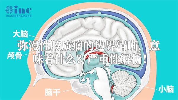 弥漫性胶质瘤的边界清晰，意味着什么？严重性解析！