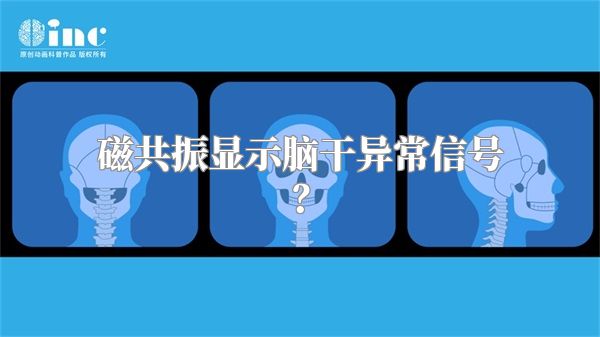 磁共振显示脑干异常信号？