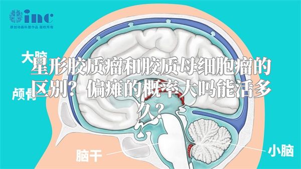 星形胶质瘤和胶质母细胞瘤的区别？偏瘫的概率大吗能活多久？