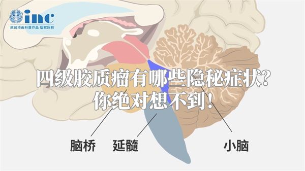 四级胶质瘤有哪些隐秘症状？你绝对想不到！