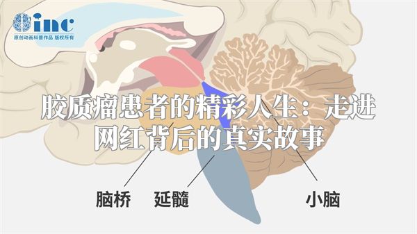 胶质瘤患者的精彩人生：走进网红背后的真实故事