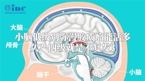 小脑低级别弥漫胶质瘤能活多久？四级就是不复发？