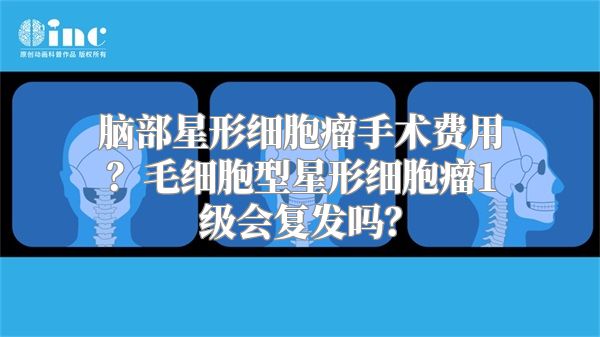 脑部星形细胞瘤手术费用？毛细胞型星形细胞瘤1级会复发吗？