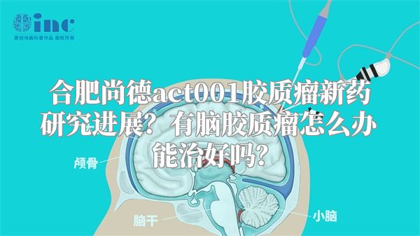 合肥尚德act001胶质瘤新药研究进展？有脑胶质瘤怎么办能治好吗？