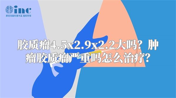 胶质瘤4.5x2.9x2.2大吗？肿瘤胶质瘤严重吗怎么治疗？