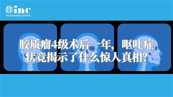 胶质瘤4级术后一年，呕吐症状竟揭示了什么惊人真相？