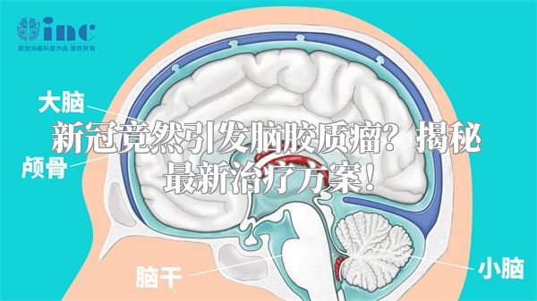 新冠竟然引发脑胶质瘤？揭秘最新治疗方案！