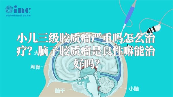 小儿三级胶质瘤严重吗怎么治疗？脑子胶质瘤是良性嘛能治好吗？