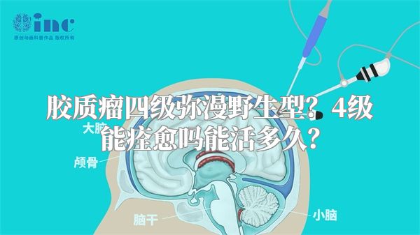 胶质瘤四级弥漫野生型？4级能痊愈吗能活多久？