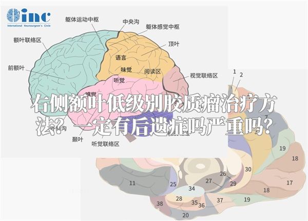 右侧额叶低级别胶质瘤治疗方法？一定有后遗症吗严重吗？