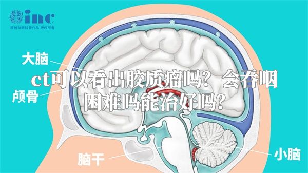 ct可以看出胶质瘤吗？会吞咽困难吗能治好吗？