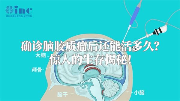 确诊脑胶质瘤后还能活多久？惊人的生存揭秘！