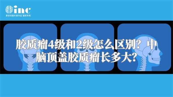 胶质瘤4级和2级怎么区别？中脑顶盖胶质瘤长多大？