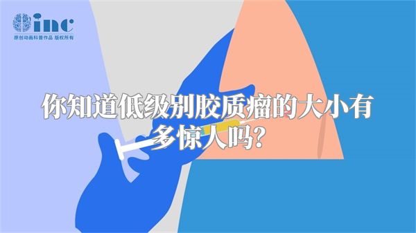 你知道低级别胶质瘤的大小有多惊人吗？