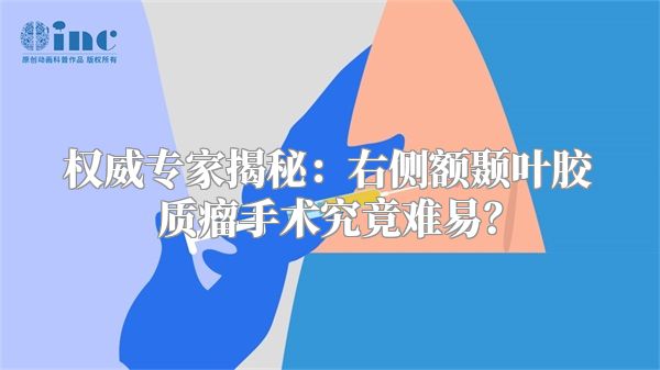 权威专家揭秘：右侧额颞叶胶质瘤手术究竟难易？