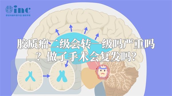 胶质瘤二级会转一级吗严重吗？做了手术会复发吗？