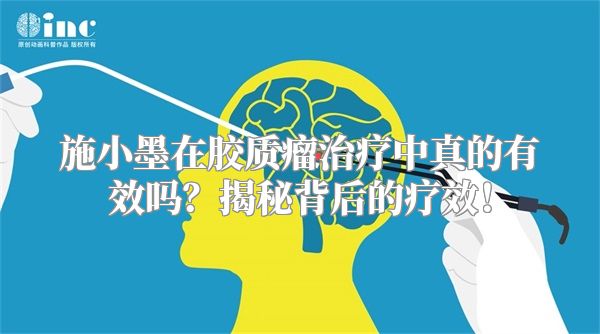 施小墨在胶质瘤治疗中真的有效吗？揭秘背后的疗效！