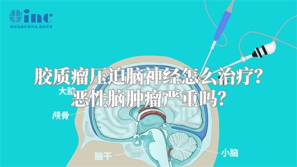 胶质瘤压迫脑神经怎么治疗？恶性脑肿瘤严重吗？