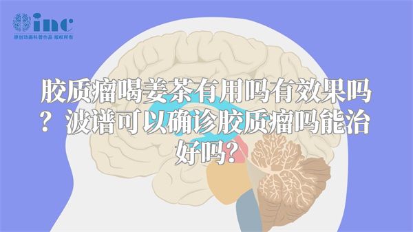 胶质瘤喝姜茶有用吗有效果吗？波谱可以确诊胶质瘤吗能治好吗？