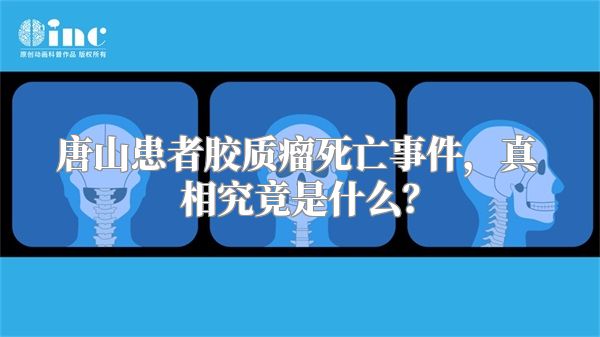 唐山患者胶质瘤死亡事件，真相究竟是什么？