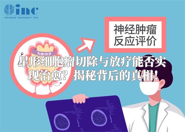 星形细胞瘤切除与放疗能否实现治愈？揭秘背后的真相！