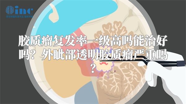 胶质瘤复发率一级高吗能治好吗？外眦部透明胶质瘤严重吗？