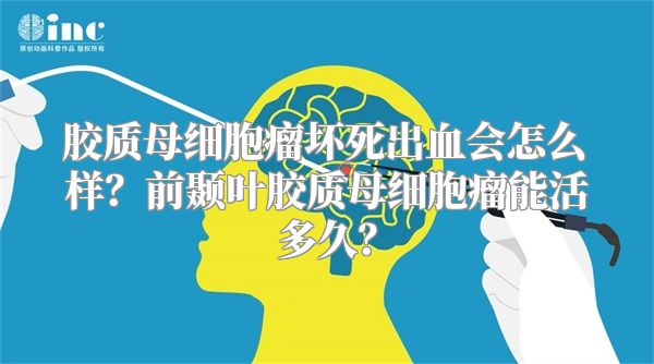 胶质母细胞瘤坏死出血会怎么样？前颞叶胶质母细胞瘤能活多久？