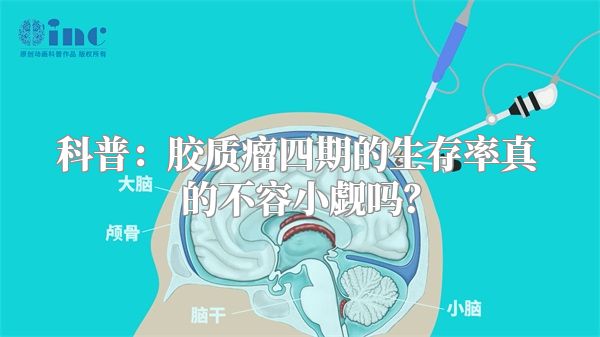 科普：胶质瘤四期的生存率真的不容小觑吗？