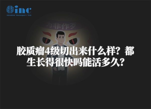 胶质瘤4级切出来什么样？都生长得很快吗能活多久？