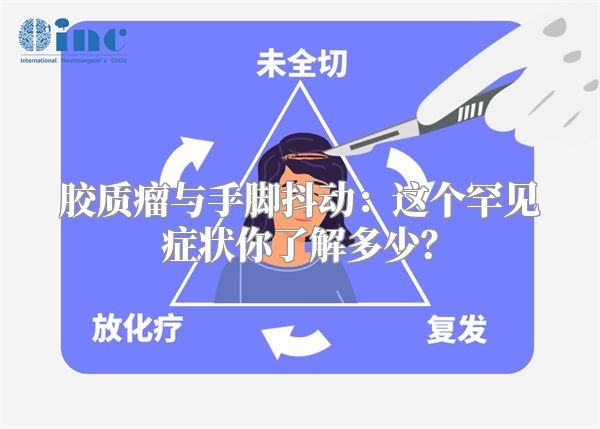 胶质瘤与手脚抖动：这个罕见症状你了解多少？