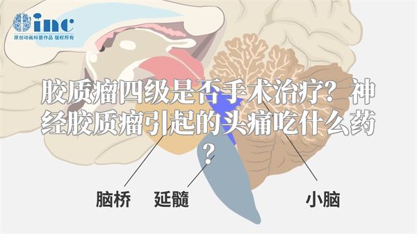 胶质瘤四级是否手术治疗？神经胶质瘤引起的头痛吃什么药？