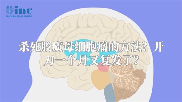 杀死胶质母细胞瘤的方法？开刀一个月又复发了？