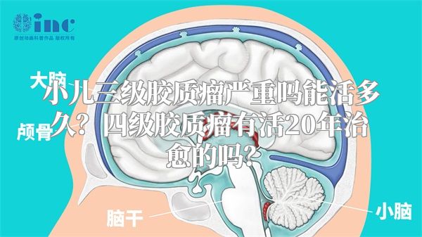 小儿三级胶质瘤严重吗能活多久？四级胶质瘤有活20年治愈的吗？