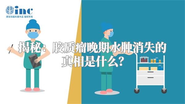 揭秘：胶质瘤晚期水肿消失的真相是什么？