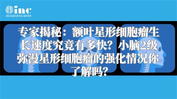 专家揭秘：额叶星形细胞瘤生长速度究竟有多快？小脑2级弥漫星形细胞瘤的强化情况你了解吗？