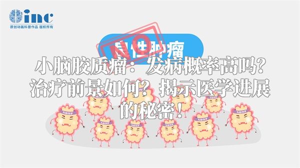 小脑胶质瘤：发病概率高吗？治疗前景如何？揭示医学进展的秘密！