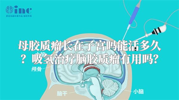 母胶质瘤长在子宫吗能活多久？吸氢治疗脑胶质瘤有用吗？