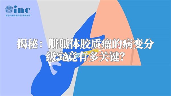 揭秘：胼胝体胶质瘤的病变分级究竟有多关键？