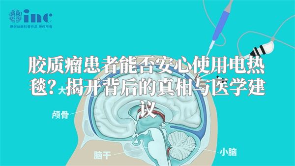 胶质瘤患者能否安心使用电热毯？揭开背后的真相与医学建议